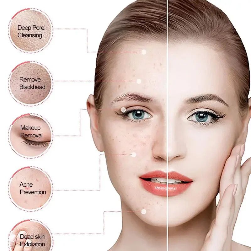 LED Waterproof Electric Facial Brush for Blackhead Removal and Pore Cleansing